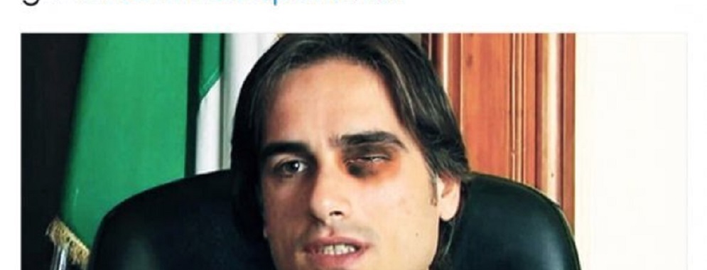 Reggio Calabria, il sindaco con l’occhio nero: parlamentare M5s twitta la foto fake