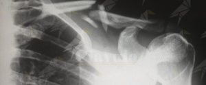 Dipendenti del centro radiologico di Siderno senza stipendio da mesi, solidarietà dall’Assemblea dei Sindaci item-thumbnail
