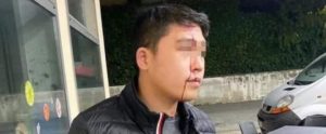 “Hai il coronavirus, non puoi entrare!”: gli spaccano una bottiglia in testa perché cinese item-thumbnail