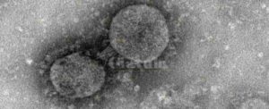 Coronavirus: domani arriveranno a Pratica di Mare 9 cittadini italiani di ritorno da Wuhan item-thumbnail