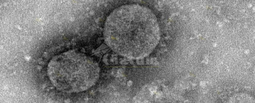 Coronavirus, un caso positivo a Palmi