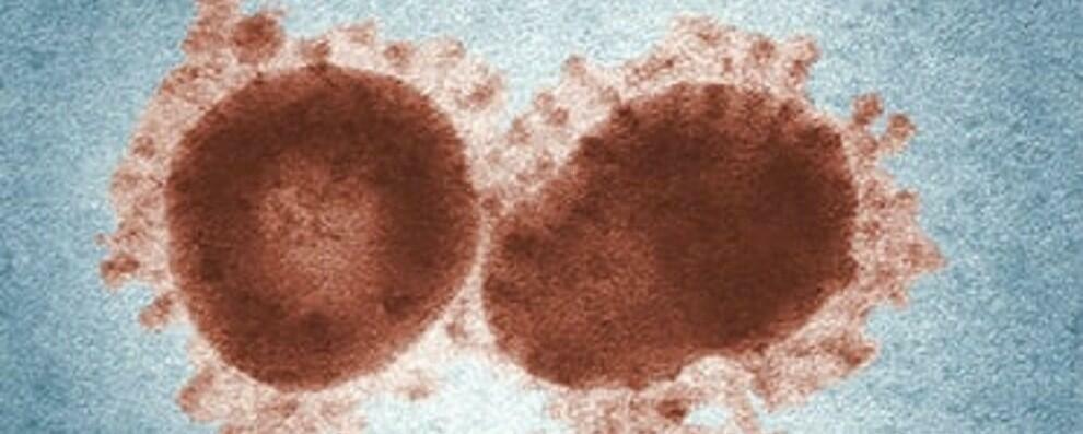 Coronavirus, primo caso positivo a Cinquefrondi