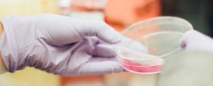 Coronavirus, da oggi parte il test sierologico in 2mila comuni item-thumbnail