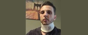 Picchiato a Milano poliziotto disabile originario di Locri item-thumbnail