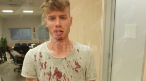 Potere al Popolo: “Aggredito senza alcun motivo da un poliziotto in borghese” item-thumbnail