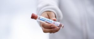 Cronavirus, in Calabria 2 decessi e 75 nuovi contagi nelle ultime 24 ore item-thumbnail
