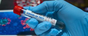 Coronavirus, cresce ancora il numero dei positivi in Calabria: 1590 nuovi casi in 24 ore item-thumbnail