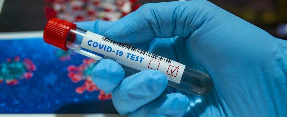 Oggi in Calabria 344 nuovi casi di positività al coronavirus