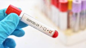Oggi in Calabria si registrano 270 nuovi casi positivi item-thumbnail