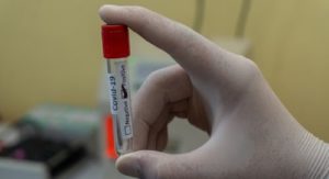 In Calabria sono 73 i nuovi positivi al coronavirus item-thumbnail