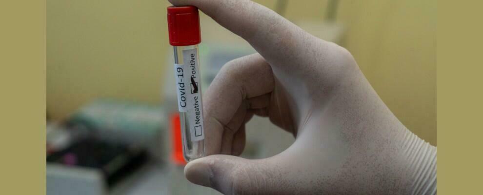 Coronavirus, in Calabria 136 nuovi casi nelle ultime 24 ore