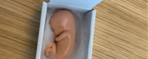 Feto di plastica all’eurodeputata Pina Picierno, la solidarietà di Vincenzo Marra item-thumbnail