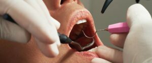 Denunciato un falso dentista nel reggino: beccato dai Nas mentre stava per operare un paziente item-thumbnail