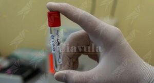 In Calabria sono 93 i nuovi positivi al coronavirus item-thumbnail